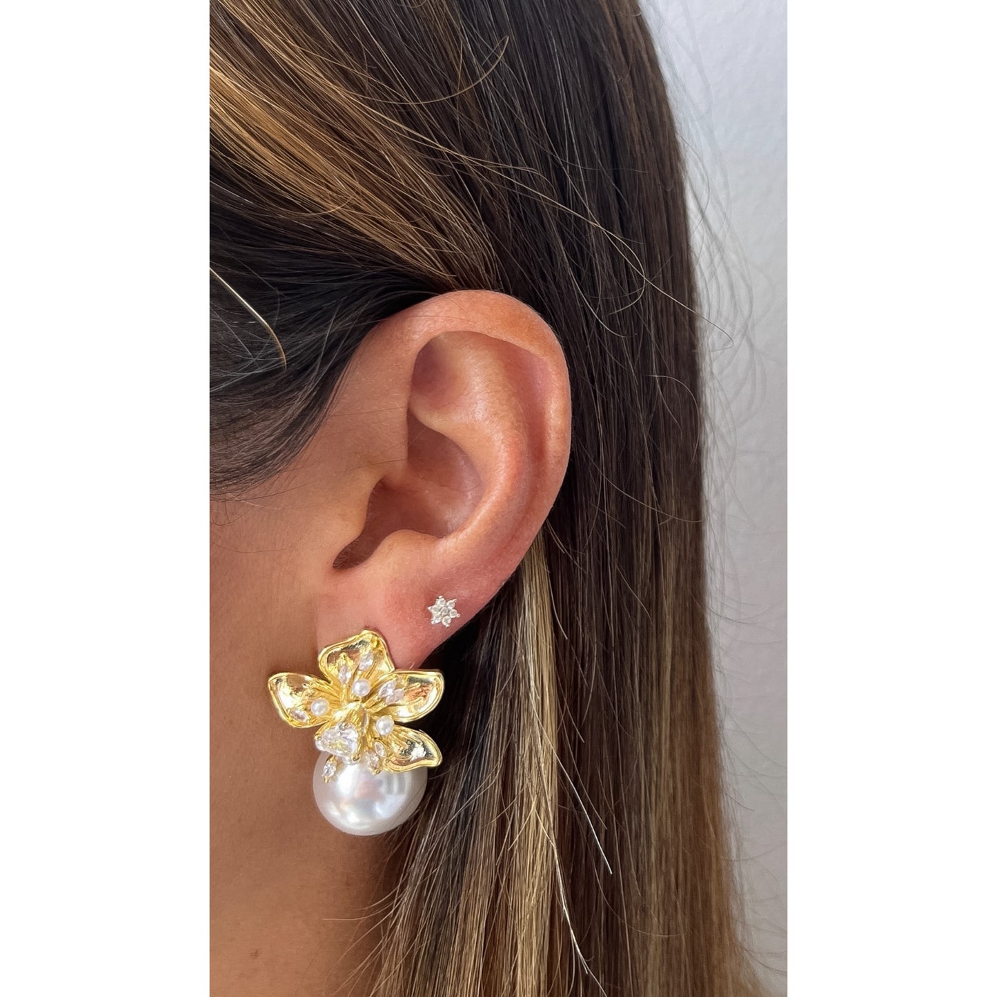 Aretes ZORTI