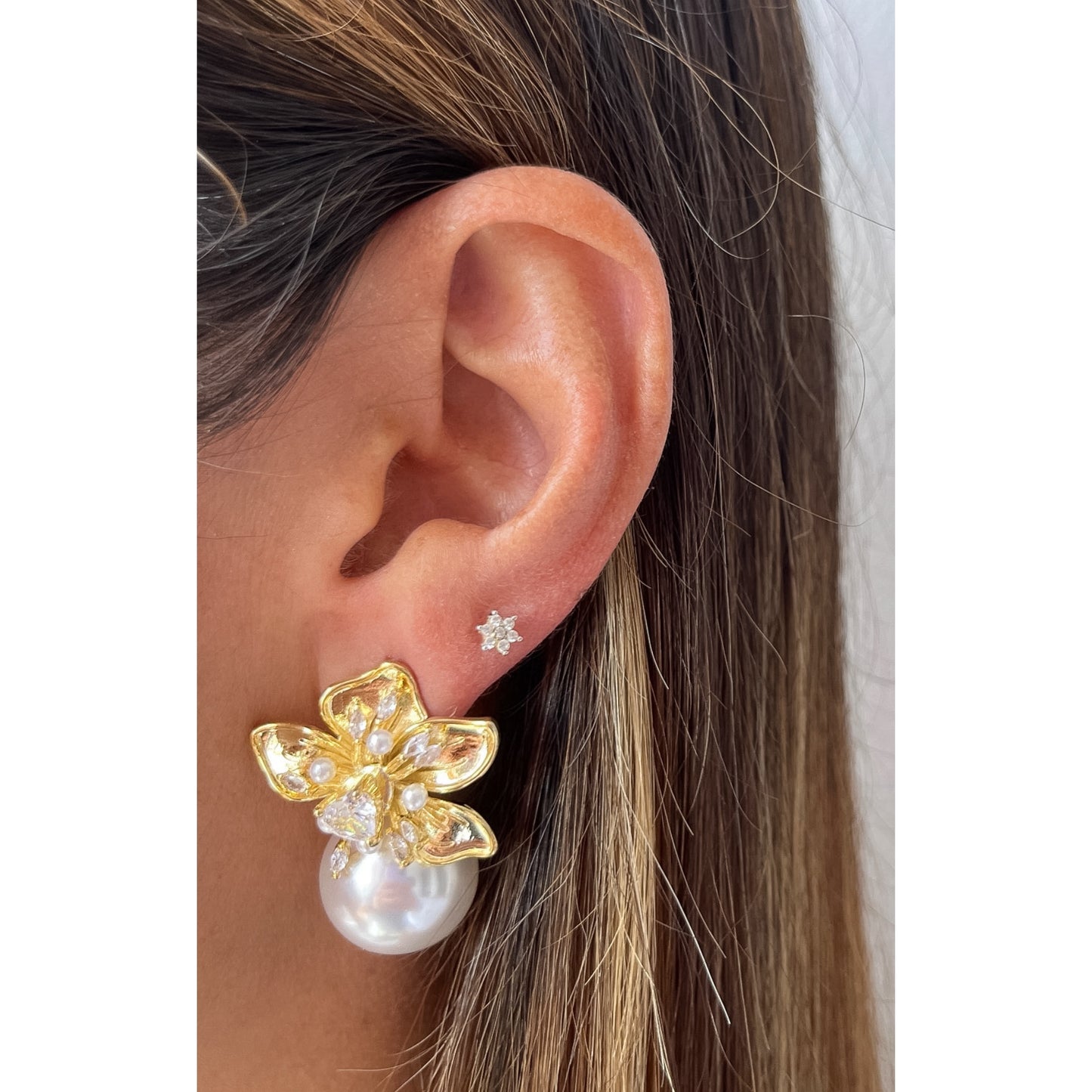 Aretes ZORTI